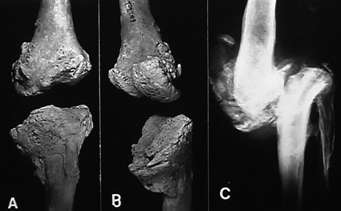 Bulletin. ed spur of the hind tibia rather short and broad