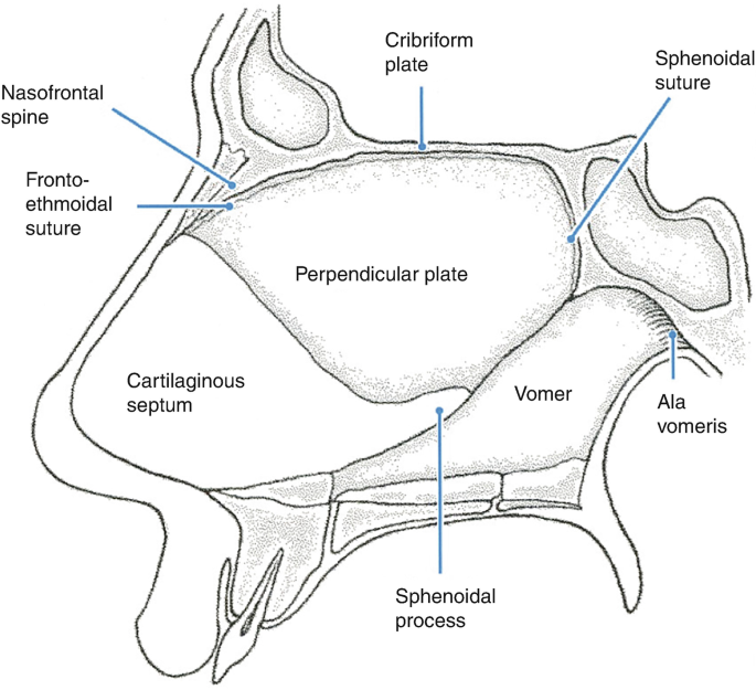 An illustration of the nasal septum with parts labeled for cribriform plate, sphenoidal suture, ala vomeris, sphenoidal process, come, perpendicular plate, cartilaginous septum, frontoethmoidal suture, and nasofrontal spine.