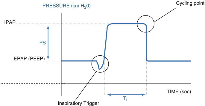 A graph plots pressure versus time. Following an inspiratory trigger, the waveform changes from being originally parallel to the time axis to being rectangular. The cycling point is the location where the wave begins to decelerate. The rectangle's height denotes P S.