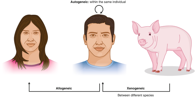 An illustration of the allogenic and xenogeneic transplants between a man and a woman and a man and a pig, respectively. Xenogeneic is labeled between different species. A cyclic arrow above the head of the man labeled autogenic, within the same individual.