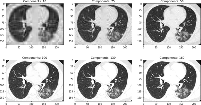 6 covid C T scan images of components 10, 25, 50, 100, 130, and 160.