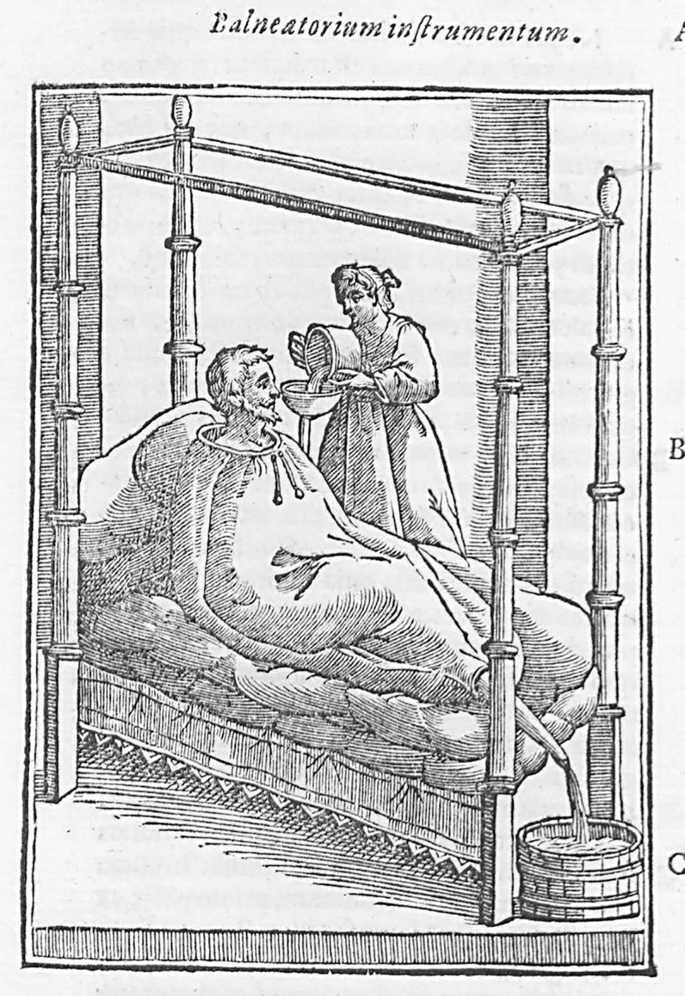 A sketch shows a man on a bed and a woman pouring water into the vessel attached to the man's body.