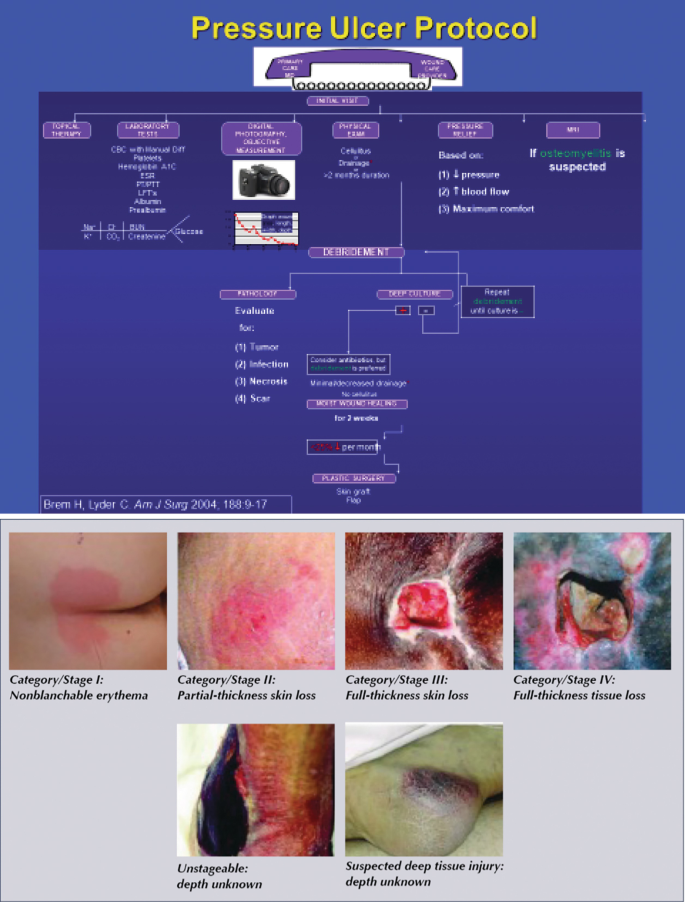 Repositioning Techniques Poster Pressure Ulcers