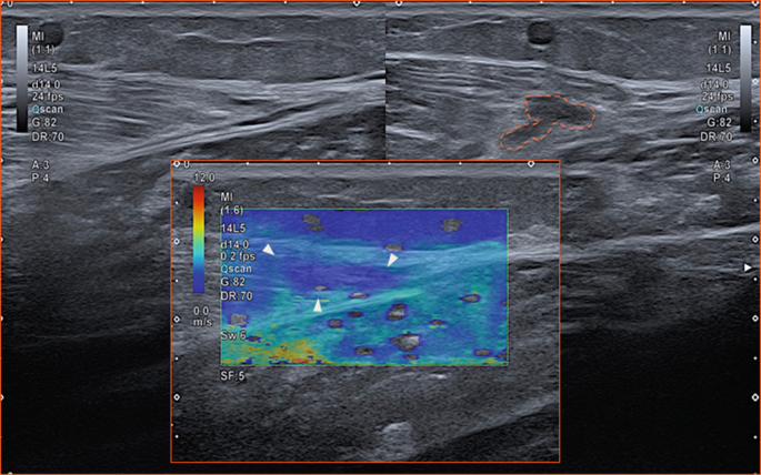 A scanned image with dark and light shades with an overlapping-colored scan. The color scale ranges from 0.0 meters per second to 12.0.