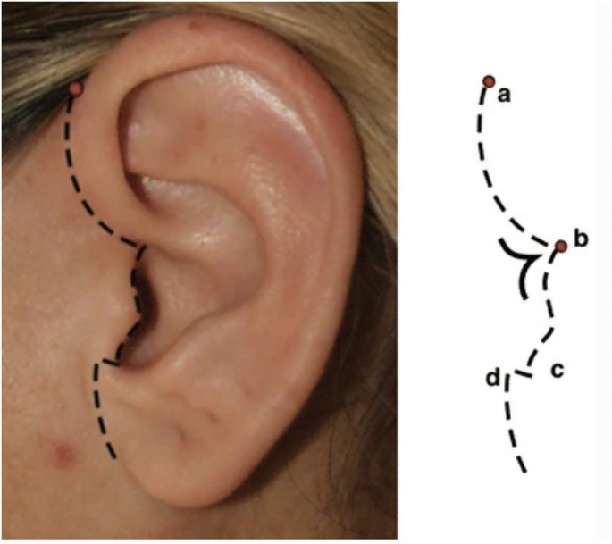 Silicone Tongue Section Model Piercing Training Jewellery Display  Acupuncture 