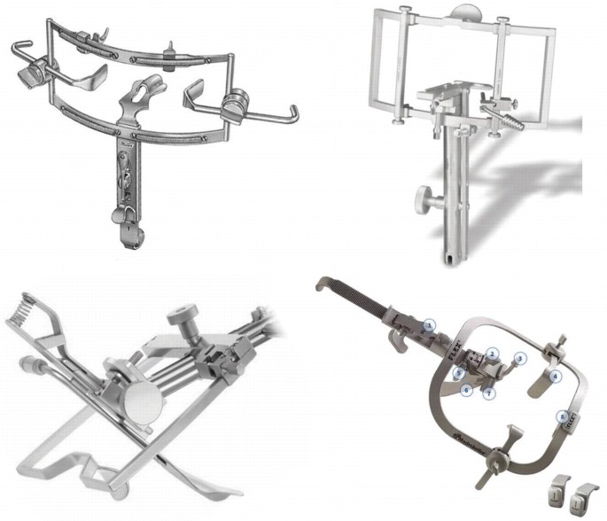 Surgical procedure A: FK-WO retractor. A short blade to expose the