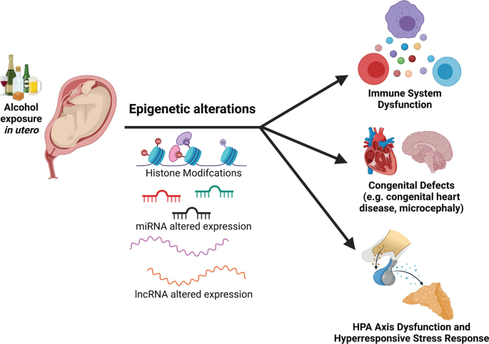 A schematic diagram where alcohol exposure in utero through epigenetic alterations leads to immune system dysfunction, congenital defects like congenital heart disease, and H P A axis dysfunction and hyperresponsive stress response.