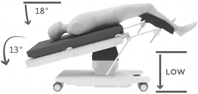 A 3-D model represents the supine position of the patient. The head portion of the body is tilted downwards from the horizontal plane. The angles on the head side read 18 degrees and 13 degrees.