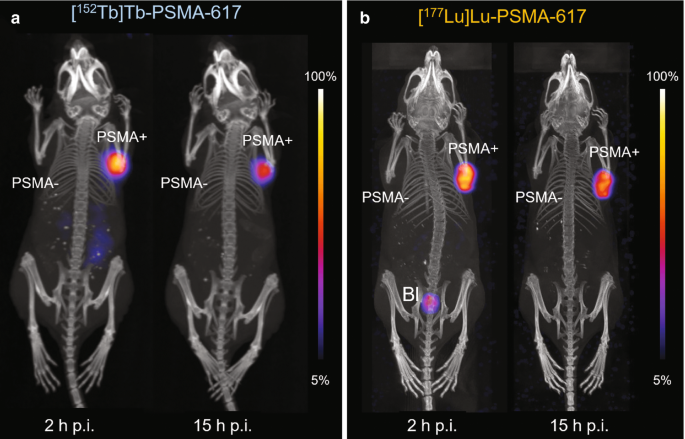 4 full body images of mice with P S M A negative and P S M A positive at 2 and 15 h p i respectively. A bright spot of intensity is present.