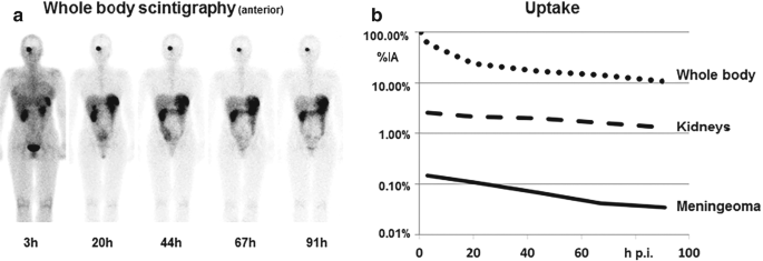 2 parts. A. 6 scanned images of the human body. The visualization of the tumor affected regions increases from 3 hours to 91 hours in some areas but decreases in a few. A line graph of percent I A versus uptake. The plots of the whole body, kidneys, and meningioma follow negative trends.