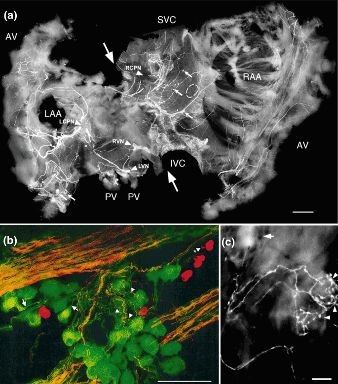 3 images of the pig heart. Image A displays both atria with marked regions. Image B illustrates the ganglion with labeled oval-shaped cells. Image C reveals the ganglion nerves with varicosites.