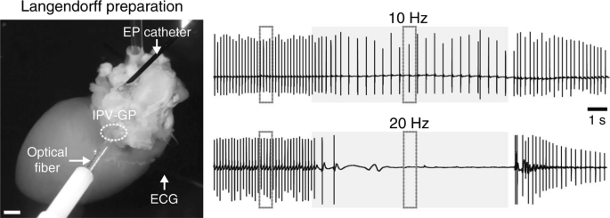 Left, A photograph of Langendorff's preparation of a mouse heart highlights the optical fiber, I P V G P, and E C G. Right, 2 traces at 10 hertz and 20 hertz illustrate heart rate response. The lower trace indicates a slow heart rate.