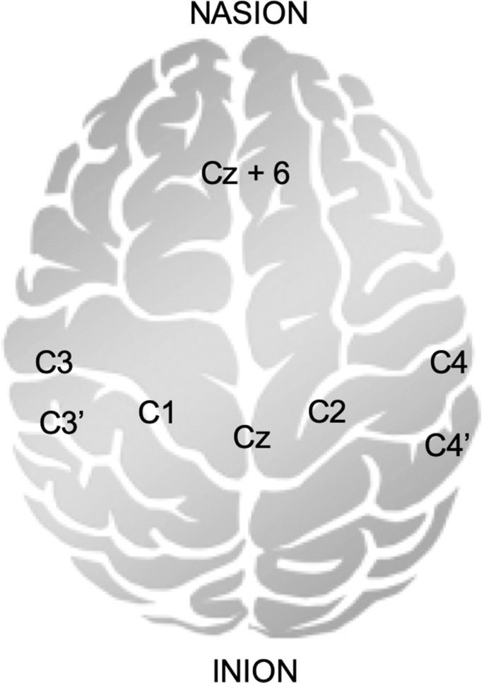 A-D) The spontaneous fusion between C2 and C3 and a broken wire