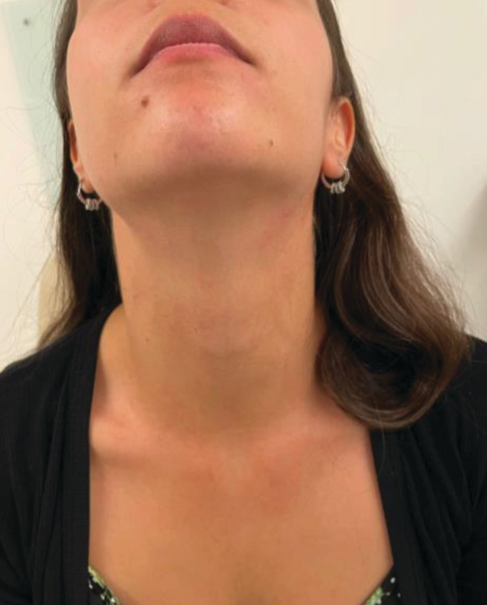 A photo of the third-fourth face and neck of a woman who looks up.