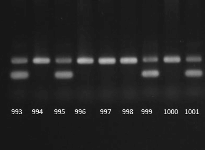An electrophoresis gel results are shown against a dark background. It has light to slightly light shades in two rows and nine columns.