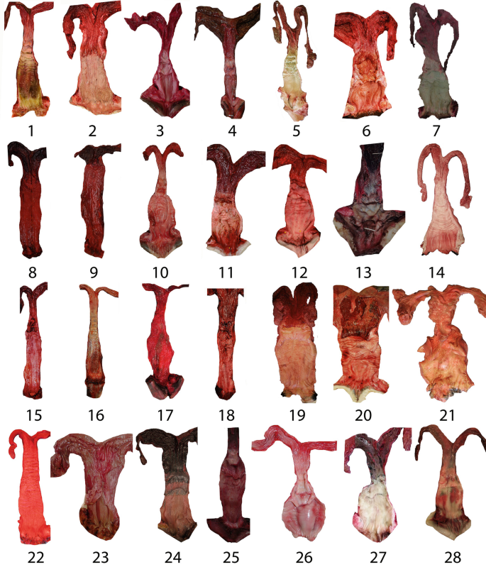 A photograph of 28 resected specimens of reproductive tracts.