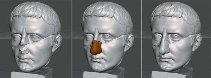 3 illustrations. Left. Head of Augustus with a lesion on the nose area. Middle. Head of the Augustus highlighting the integration of the missing part with a patch. Right. The final result.