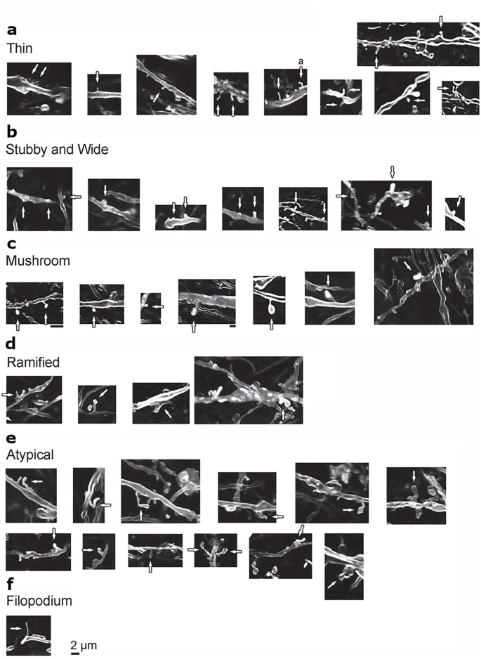 40 reconstructed micrographs of 6 types of dendritic spines. A, B, C, D, E, and F have 9, 7, 7, 4, 12, and 1 dendritic spine structures for the types, thin, stubby and wide, mushroom, ramified, atypical, and filopodium. The dendritic spines appear bright in all micrographs.