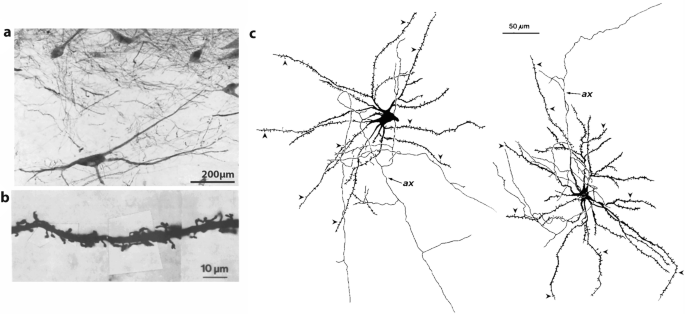 2 photomicrographs and 2 diagrams. A has a dendritic structure of a neuron. The dendrite and the branchings are in a dark shade. B has a dendrite segment with tiny protrusions in a dark shade. C has 2 dendritic structures with multiple branchings and labeled axons.