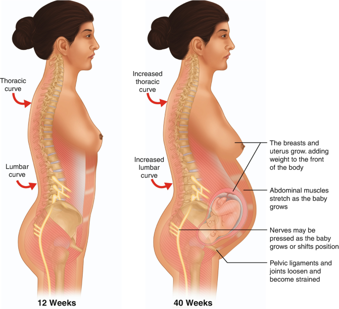 Low Back Pain and Sciatica in Pregnancy