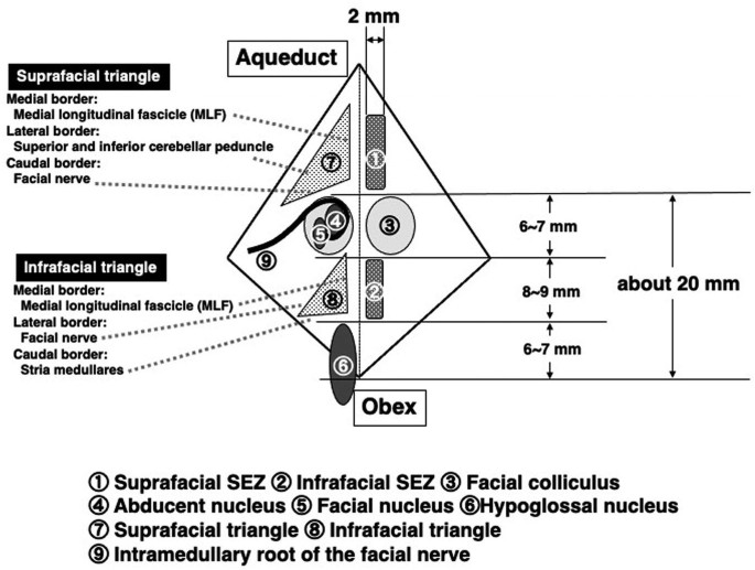 A schematic of the floor of the fourth ventricle. It labels an aqueduct, obex, suprafacial triangle, and infrafacial triangle along with their medial, lateral, and caudal borders. The measurements of the parts are mentioned.