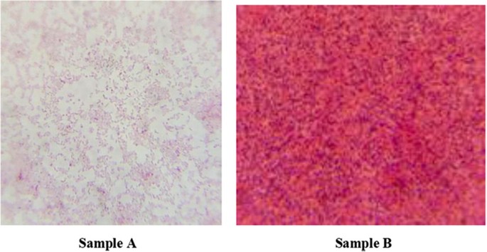 Illustrations of two Gram staining samples. The one on the left has a light color. The one on the right has a dark color.