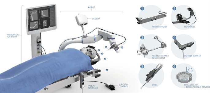 An illustration. On the left is a robotic system with parts labeled for navigation platform, robot, camera, patient interface, and surgeon control. On the right are parts like robot mount, head rest, patient marker attachment, patient marker, drill, and drill mount.