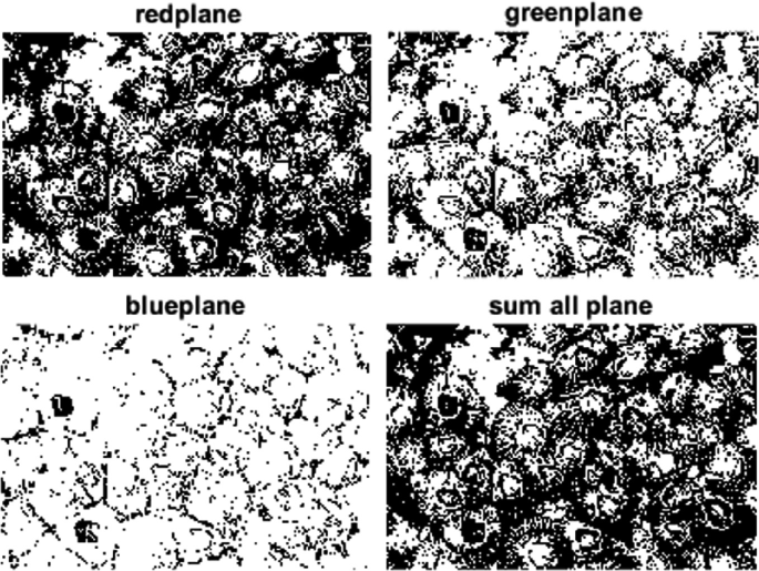 4 illustrations of barnacles in red plane, green plane, blue plane, and sum all plane. The red plane and sum all plane depict barnacles that are more prominent compared to other illustrations.