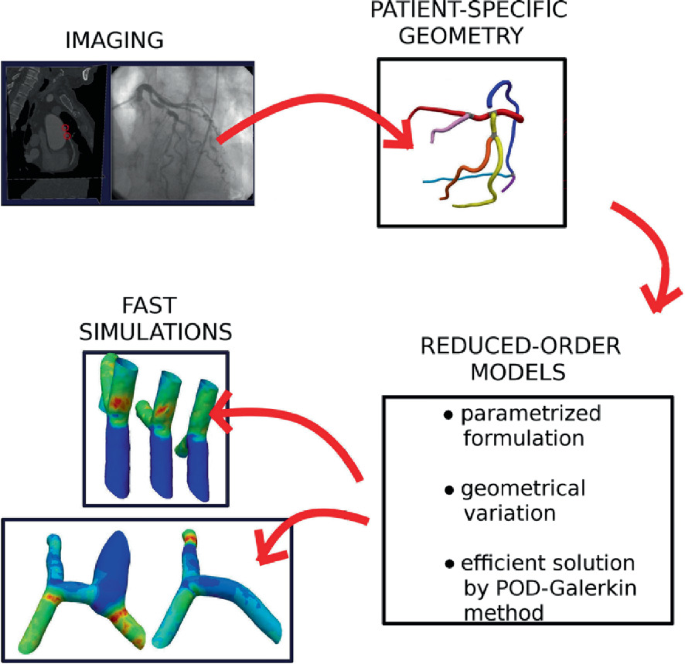 A flow diagram of biomechanical models. An imaging computational scan leads to patient-specific geometry, then to reduced-order models with three points of parameterized formulation, geometrical variation, and efficient solution by the POD-Galerkin method, and finally to fast simulations.