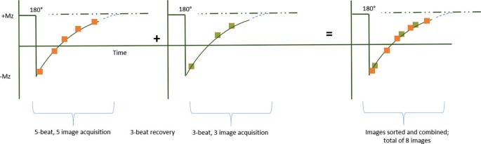 A graphical representation of the M O L L I sequence. 5 Beat, 5 image acquisition, and 3 beat recovery, plus 3 beat, 3 image acquisition, equals images sorted and combined, total of 8 images.