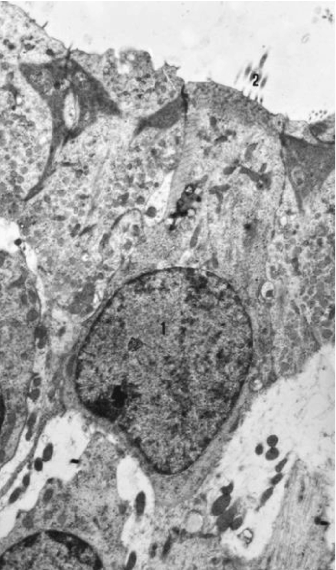 An electron micrograph of ciliated cells of crista ampullaris. Nucleus and cilia are labeled 1 and 2. Nucleus is darker in shade and round shape.