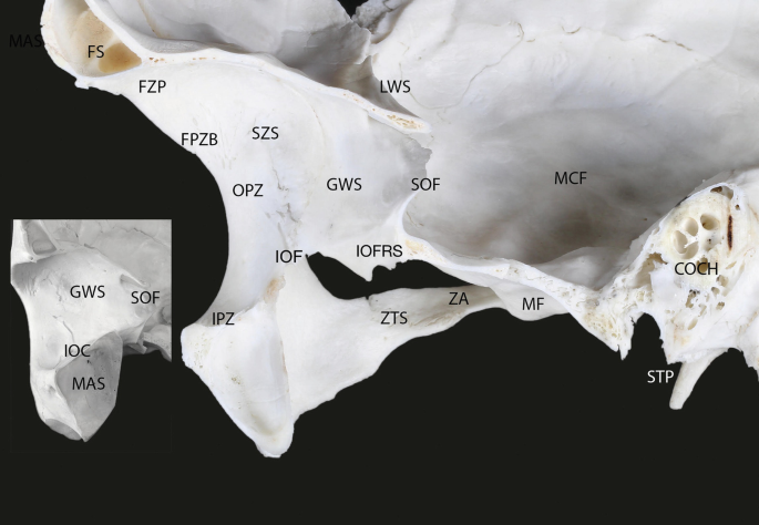 An anatomical photo of the lateral orbital wall in medial view exhibits the regions of F S, F Z P, F P Z B, S Z S, O P Z, G W S, S O F, L W S, M C F, Z T S, Z A, M F, S T P, C O C H, I O C, and M A S.