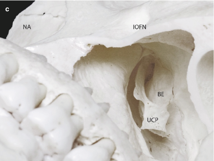 figure 23