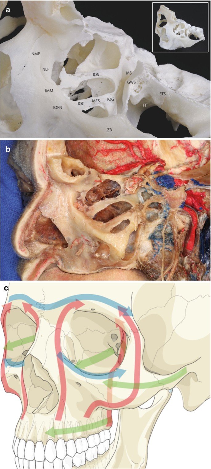 2 anatomical photos of the sagittal internal orbital buttresses in A and B exhibit the regions of N M P, N L F, I M M, I O F N, I O C, M F S, and I O G. C. An anatomical illustration of the skull with arrows highlights the regions of orbital buttresses from different aspects, indicated by arrows.