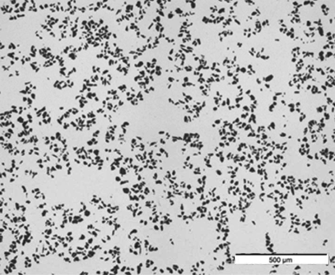 A micrograph of the Duralcan alloy zoomed at 500 micrometer presents minute particles randomly dispersed.