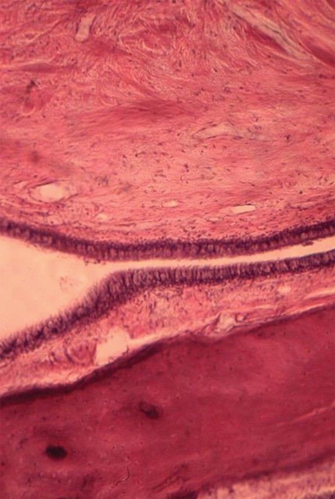 A micrograph of the eustachian tube. It has two layers with dense linings on the margin. The margins are separated by a thin gap that widens on the left. The bottom layer has a smooth patch with two dark spots on the left.