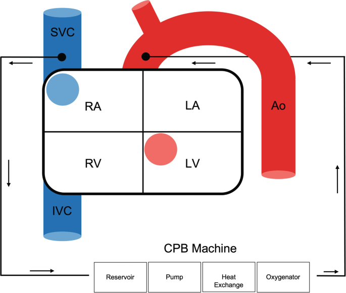 A diagram presents how the C P B machine pumps the blood from the R A and R V to the L A and L V through the reservoir, pump, heat exchange, and oxygenator in the circulatory motion.