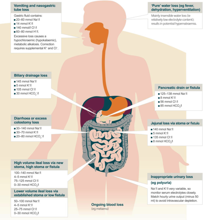 A schematic of ongoing losses. It consists of the illustration of the human body and the alimentary canal. The labeled boxes, clockwise from the top are as follows, pure water loss, pancreatic drain or fistula, jejunal loss, urinary loss, blood loss, ileal loss, diarrhea, biliary loss, and vomiting.