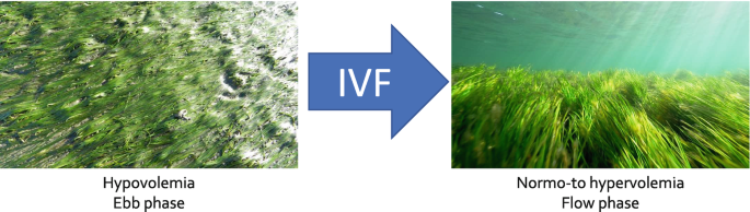 A set of 2 images illustrate the analogy to explain the effect of the administration of I V Fs. The image on the left illustrates hypovolemia ebb phase without I V F administration. The image on the right illustrates normo-to hypervolemia flow phase.