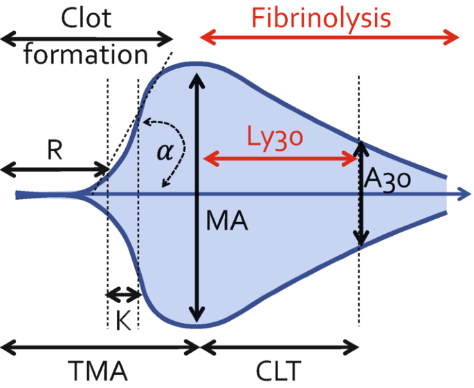 A curve for T E G parameters. The highest amplitude on both sides is M A. The section on the right and left of M A are clot formation and fibrinolysis.