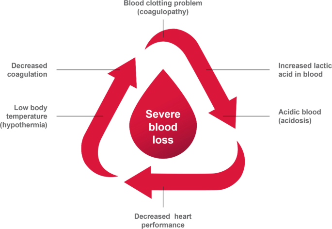 A cyclic diagram of severe blood loss effects. The effects are low body temperature, decreased coagulation, blood clotting problems, increased lactic acid in the blood, acidic blood, and decreased heart performation.