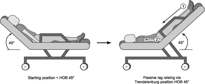 A 2-part illustration for the trolley-assisted passive leg raise. The backrest is raised at a 45-degree angle as the starting position in the first illustration. The backrest lies flat, and the footrest of the chair is raised at a 45-degree angle in the second illustration.