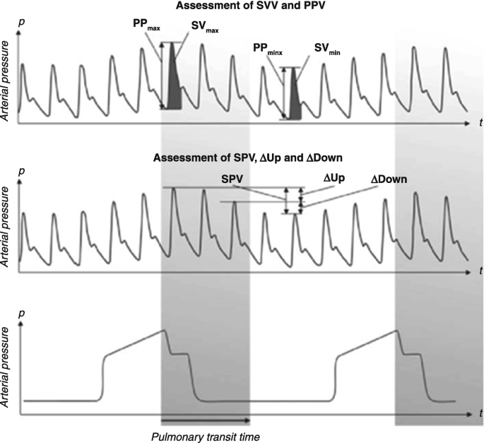 Three graphs plot the arterial pressure versus time for assessment of S V V and P V V, S P V, delta up, and delta down, and the pulmonary transit time, respectively.