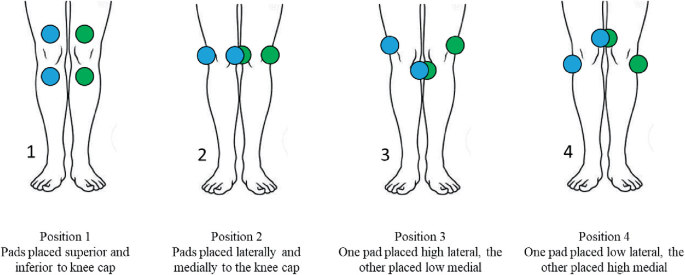 TENS Unit Placement 101: Insights into Effective Electrode Positioning