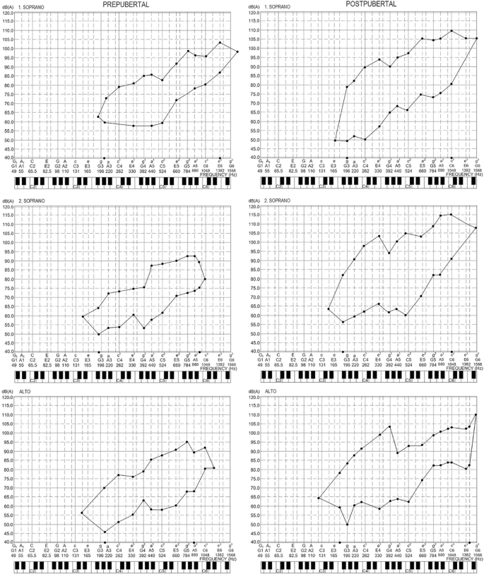 6 line graphs depict decibels versus frequency in hertz. They indicate the varied shapes corresponding to the voices of girls in different age groups in the pre-pubertal and post-pubertal stages, denoting reduced intensity in the middle.