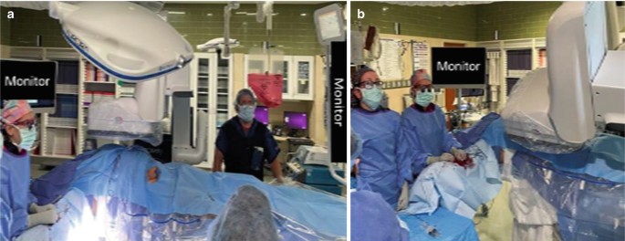 2 photos of the operating setup in the lateral and frontal views. The surgeons operate on the right brachial artery in the dissected abdomen of the patient on the surgical table.