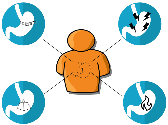 An illustration of the symptoms of functional dyspepsia. The symptoms include epigastric pain, epigastric burning, postprandial heaviness, and early satiety.