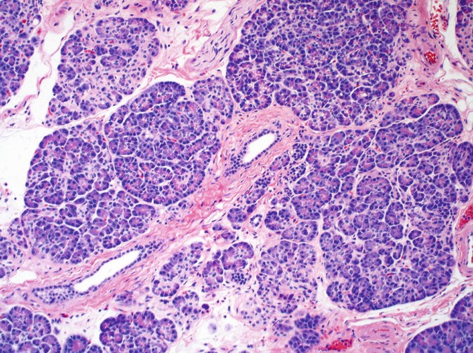 A cytological slide of the cells. Lightly pigmented cytoplasm divides the oblong formations. The nucleus within the lobular structure has a gritty look. Scattered throughout the cytoplasm are a few blood cells.