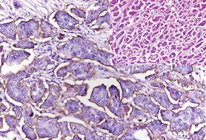 A micrograph of a tissue sample features a cross-section of the tissue with various cell types and irregular structures.