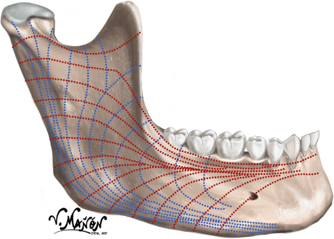 A diagram of the condylar process. Colored lines mark compression and tension along the condylar process.